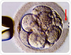 alteracoes-geneticas2