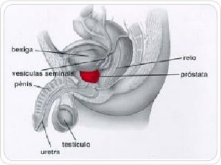 img-alt-prostasticas01