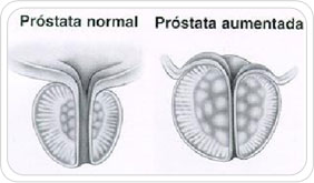 img-alt-prostasticas02