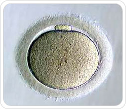 img-congelamento02